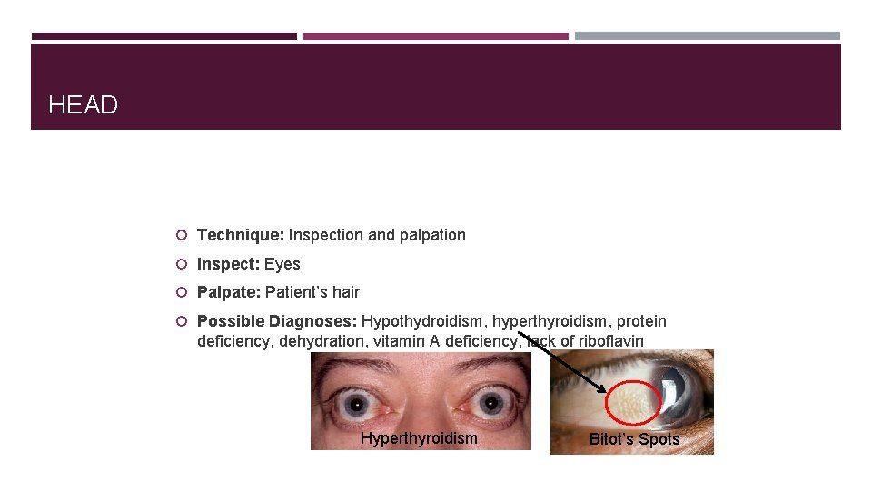 HEAD Technique: Inspection and palpation Inspect: Eyes Palpate: Patient’s hair Possible Diagnoses: Hypothydroidism, hyperthyroidism,