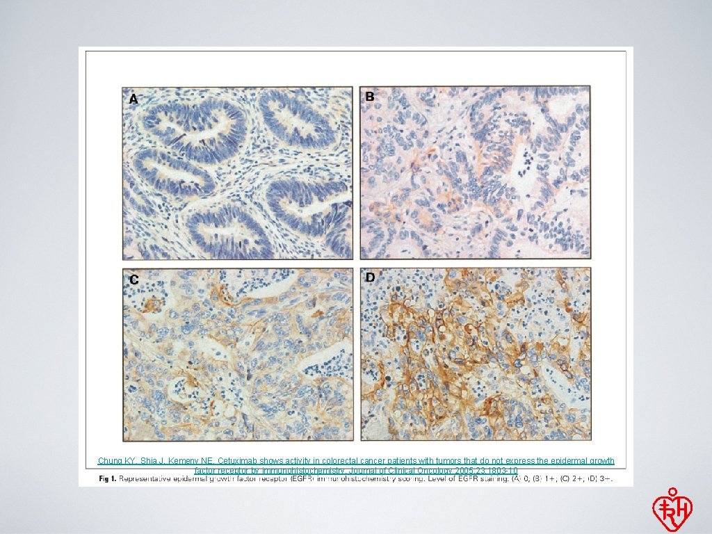 Chung KY, Shia J, Kemeny NE. Cetuximab shows activity in colorectal cancer patients with