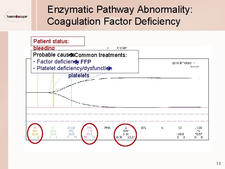 Enzymatic Pathway Abnormality: Coagulation Factor Deficiency Patient status: bleeding Probable causes Common treatments: •