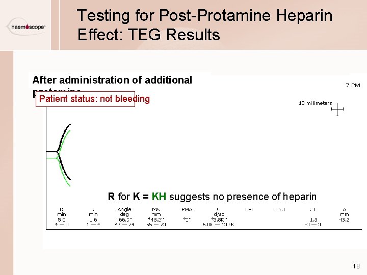 Testing for Post-Protamine Heparin Effect: TEG Results After administration of additional protamine Patient status: