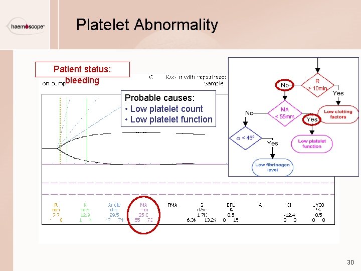 Platelet Abnormality Patient status: bleeding Probable causes: • Low platelet count • Low platelet