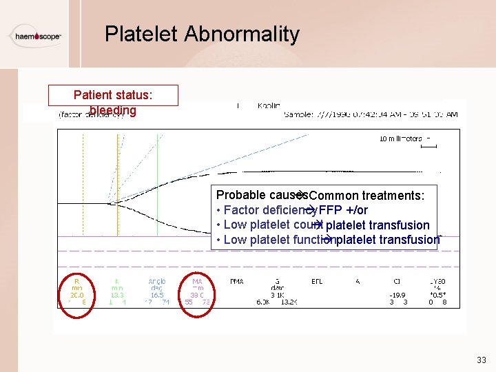 Platelet Abnormality Patient status: bleeding Probable causes Common treatments: • Factor deficiency FFP +/or