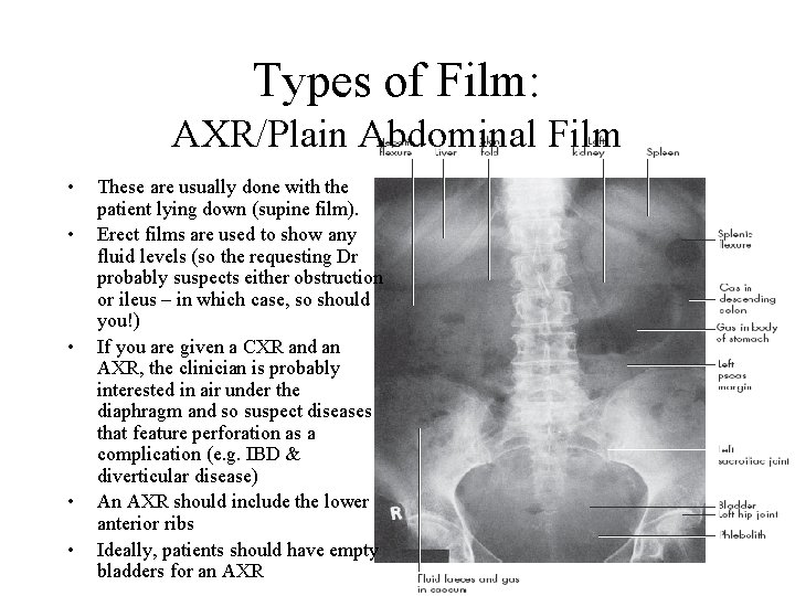 Types of Film: AXR/Plain Abdominal Film • • • These are usually done with