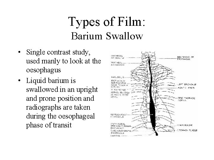 Types of Film: Barium Swallow • Single contrast study, used manly to look at