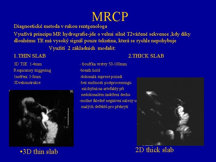 MRCP Diagnostické metoda v rukou rentgenologa Využívá principu MR hydrografie-jde o velmi silně T