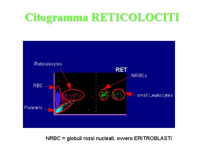 Citogramma RETICOLOCITI NRBC = globuli rossi nucleati, ovvero ERITROBLASTI 