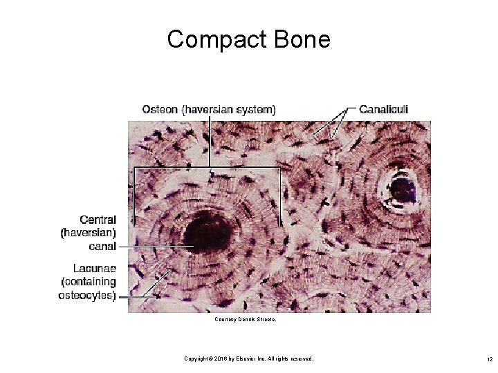 Compact Bone Courtesy Dennis Streete. Copyright © 2016 by Elsevier Inc. All rights reserved.