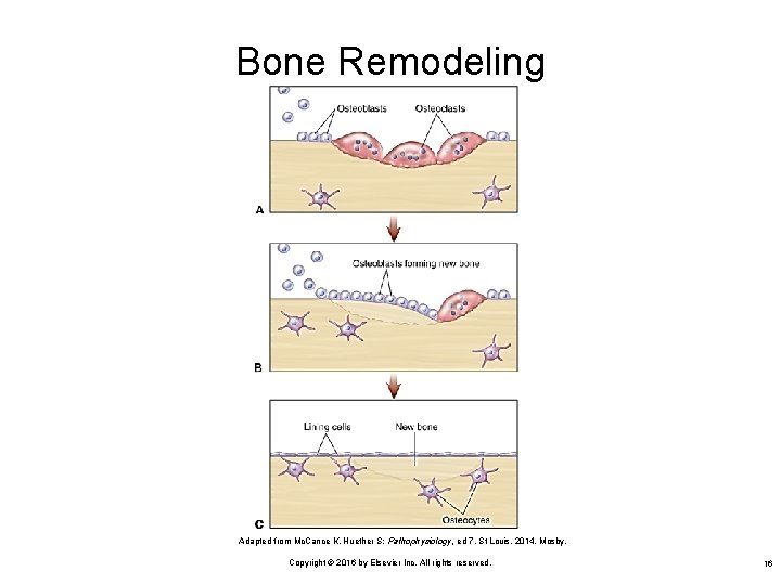 Bone Remodeling Adapted from Mc. Cance K, Huether S: Pathophysiology, ed 7, St Louis,