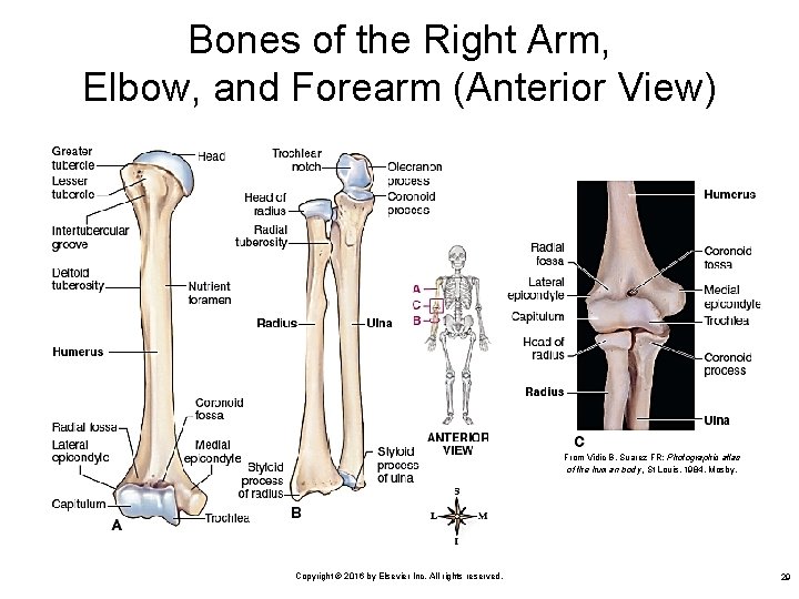 Bones of the Right Arm, Elbow, and Forearm (Anterior View) From Vidic B, Suarez