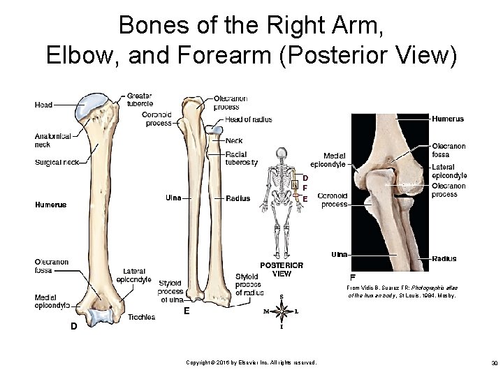 Bones of the Right Arm, Elbow, and Forearm (Posterior View) From Vidic B, Suarez