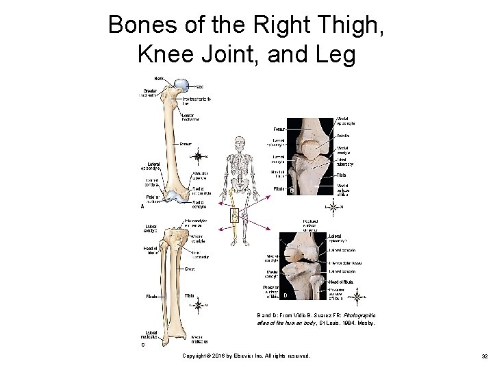 Bones of the Right Thigh, Knee Joint, and Leg B and D: From Vidic