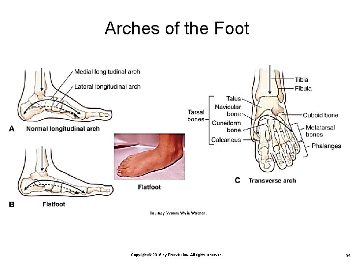 Arches of the Foot Courtesy Yvonne Wylie Walston. Copyright © 2016 by Elsevier Inc.