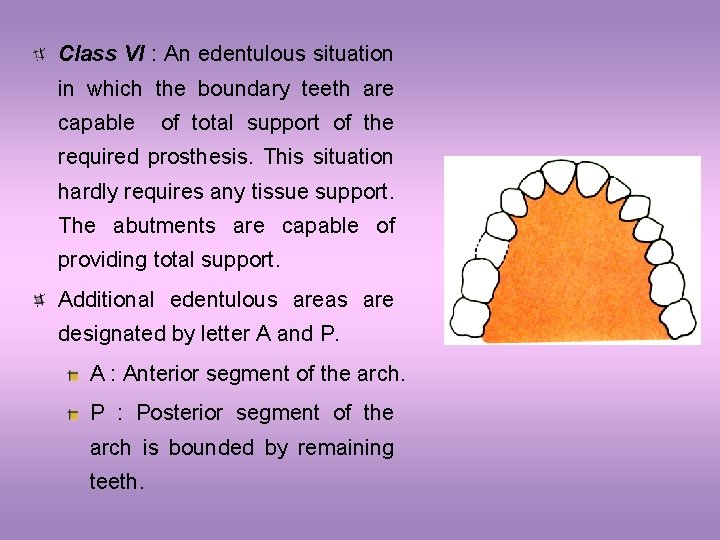 Class VI : An edentulous situation in which the boundary teeth are capable of