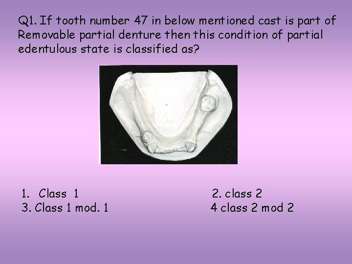 Q 1. If tooth number 47 in below mentioned cast is part of Removable