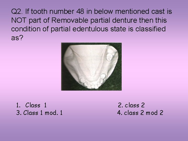 Q 2. If tooth number 48 in below mentioned cast is NOT part of