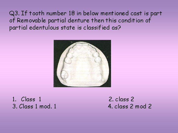 Q 3. If tooth number 18 in below mentioned cast is part of Removable