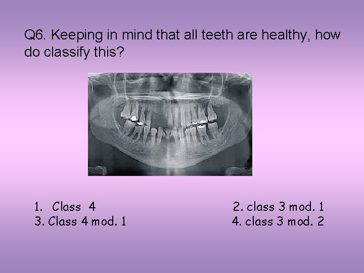 Q 6. Keeping in mind that all teeth are healthy, how do classify this?