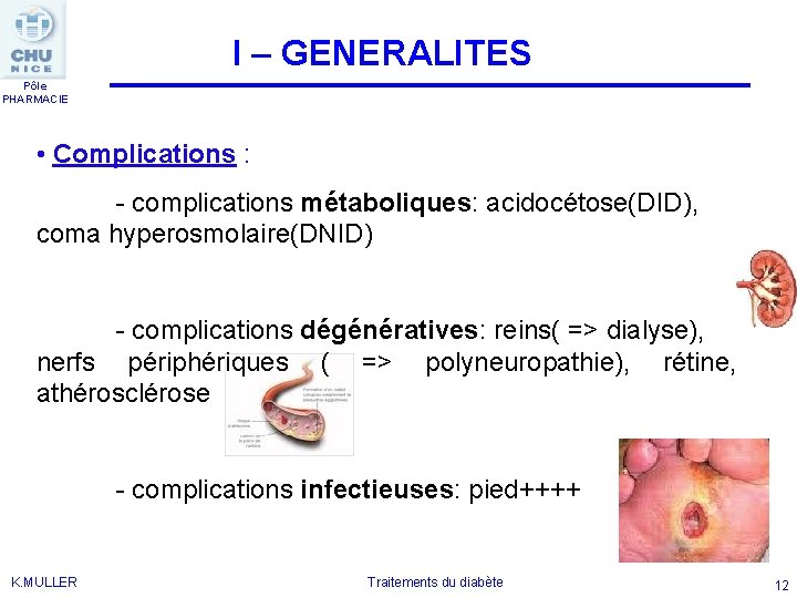 I – GENERALITES Pôle PHARMACIE • Complications : - complications métaboliques: acidocétose(DID), coma hyperosmolaire(DNID)