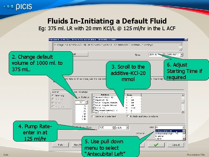 Fluids In-Initiating a Default Fluid Eg: 375 ml. LR with 20 mm KCl/L @