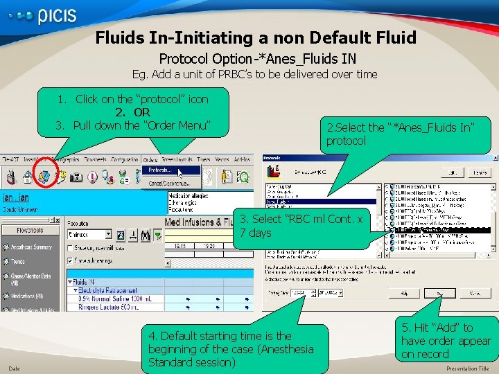 Fluids In-Initiating a non Default Fluid Protocol Option-*Anes_Fluids IN Eg. Add a unit of