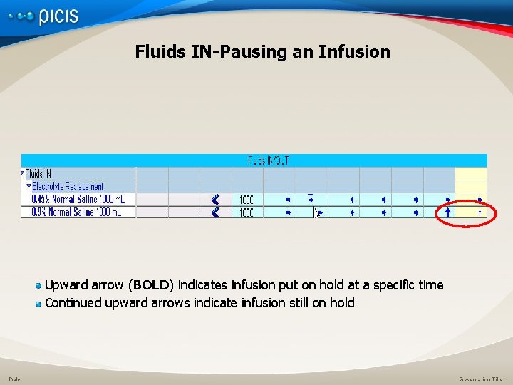 Fluids IN-Pausing an Infusion Upward arrow (BOLD) indicates infusion put on hold at a