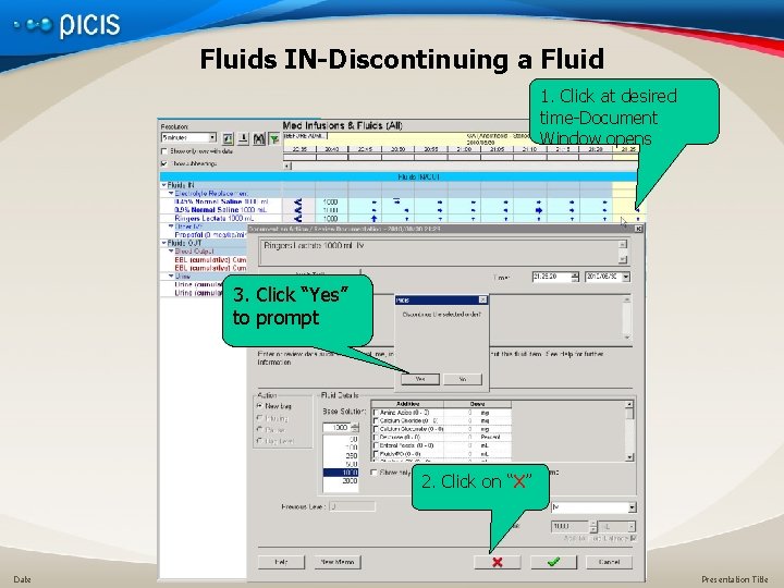Fluids IN-Discontinuing a Fluid 1. Click at desired time-Document Window opens 3. Click “Yes”