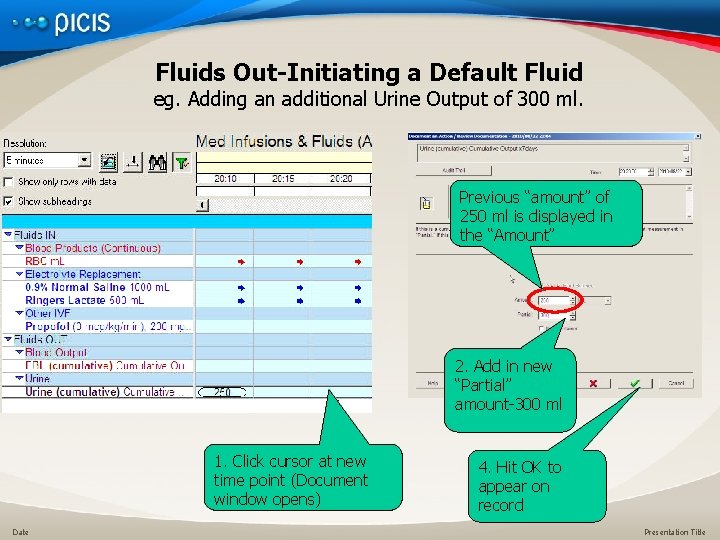 Fluids Out-Initiating a Default Fluid eg. Adding an additional Urine Output of 300 ml.