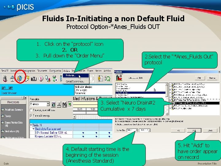Fluids In-Initiating a non Default Fluid Protocol Option-*Anes_Fluids OUT 1. Click on the “protocol”