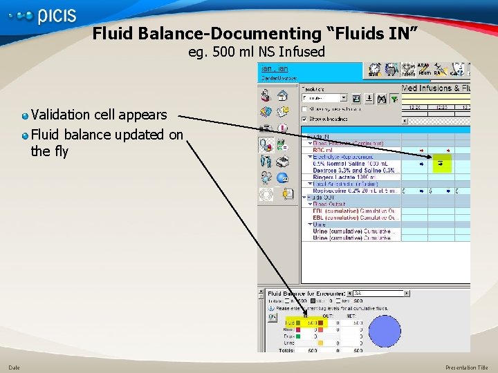 Fluid Balance-Documenting “Fluids IN” eg. 500 ml NS Infused Validation cell appears Fluid balance