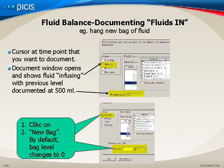 Fluid Balance-Documenting “Fluids IN” eg. hang new bag of fluid Cursor at time point