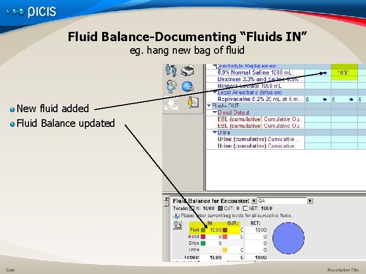 Fluid Balance-Documenting “Fluids IN” eg. hang new bag of fluid New fluid added Fluid