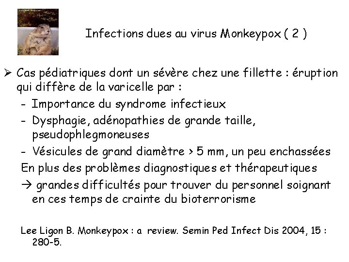 Infections dues au virus Monkeypox ( 2 ) Ø Cas pédiatriques dont un sévère