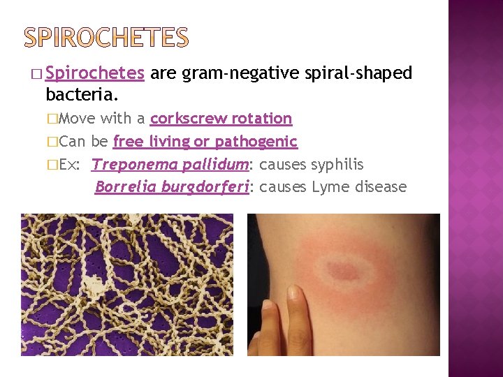 � Spirochetes are gram-negative spiral-shaped bacteria. �Move with a corkscrew rotation �Can be free