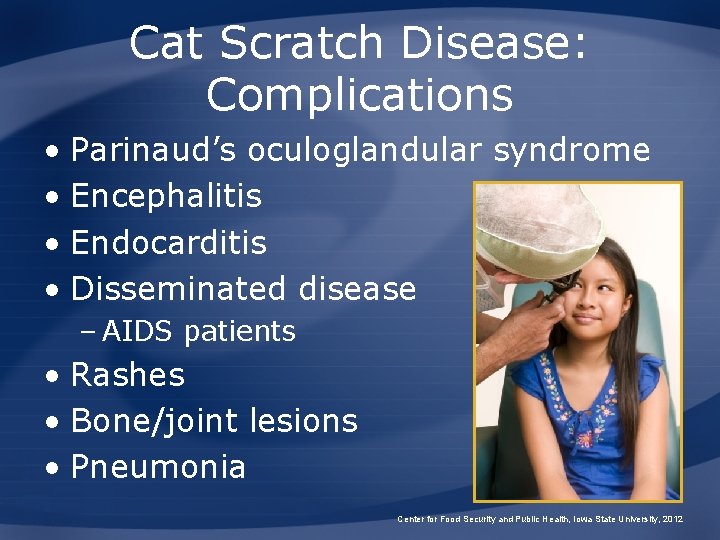 Cat Scratch Disease: Complications • Parinaud’s oculoglandular syndrome • Encephalitis • Endocarditis • Disseminated Cat Scratch Disease: Complications • Parinaud’s oculoglandular syndrome • Encephalitis • Endocarditis • Disseminated