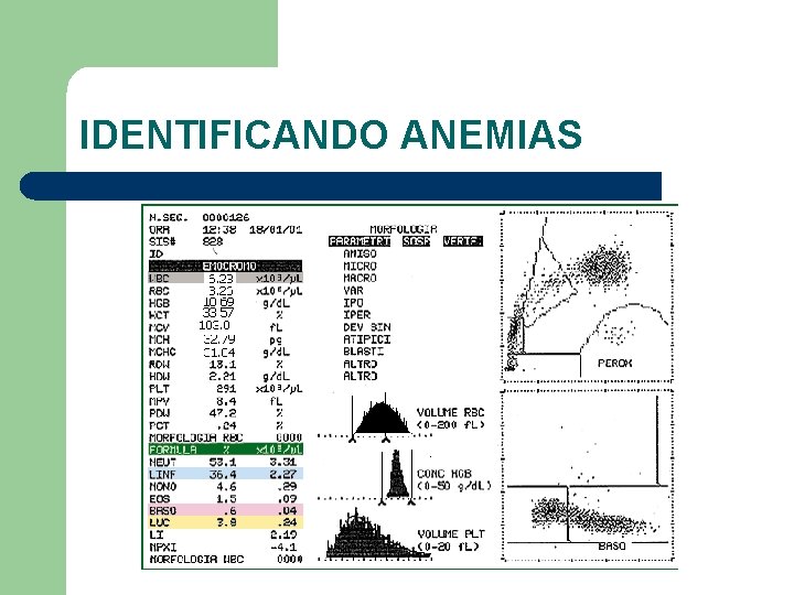 IDENTIFICANDO ANEMIAS 