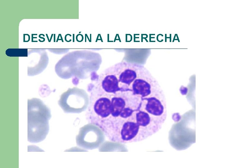 DESVIACIÓN A LA DERECHA 
