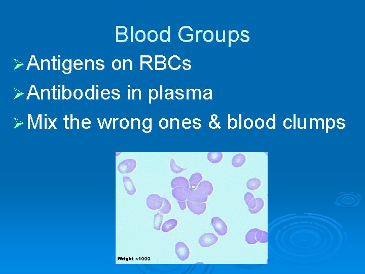 Blood Groups Ø Antigens on RBCs Ø Antibodies in plasma Ø Mix the wrong