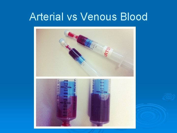 Arterial vs Venous Blood 