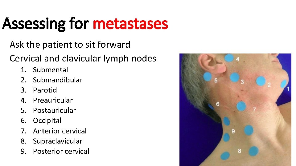 Assessing for metastases Ask the patient to sit forward Cervical and clavicular lymph nodes