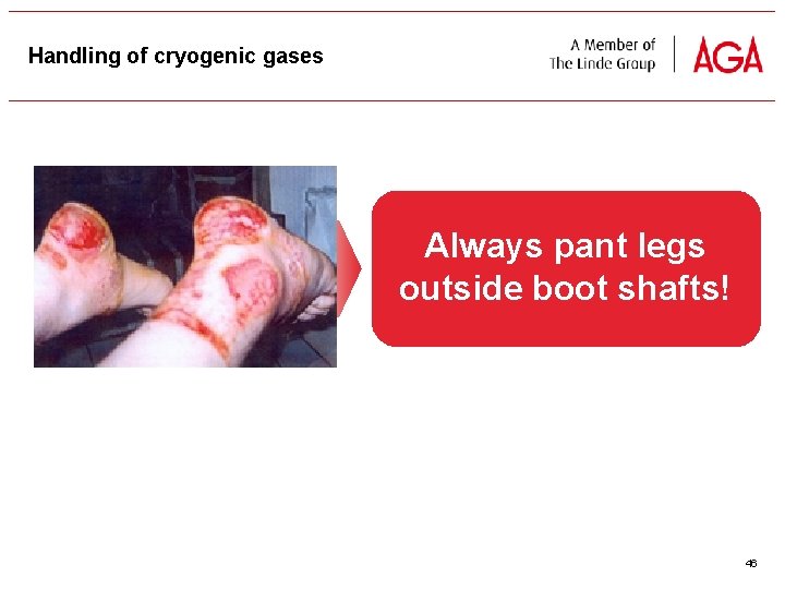 Handling of cryogenic gases Always pant legs outside boot shafts! 46 