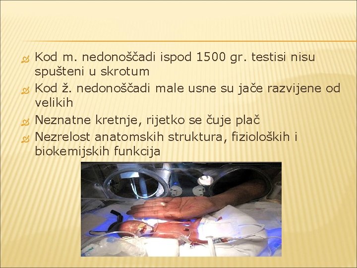  Kod m. nedonoščadi ispod 1500 gr. testisi nisu spušteni u skrotum Kod ž.