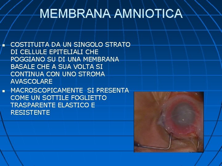 MEMBRANA AMNIOTICA COSTITUITA DA UN SINGOLO STRATO DI CELLULE EPITELIALI CHE POGGIANO SU DI
