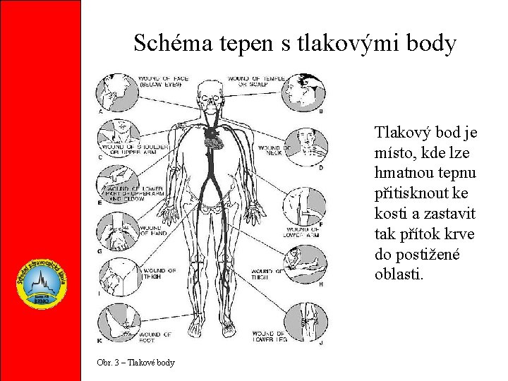 Schéma tepen s tlakovými body Tlakový bod je místo, kde lze hmatnou tepnu přitisknout