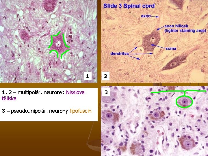 1 1, 2 – multipolár. neurony: Nisslova tělíska 3 – pseudounipolár. neurony: lipofuscin 2