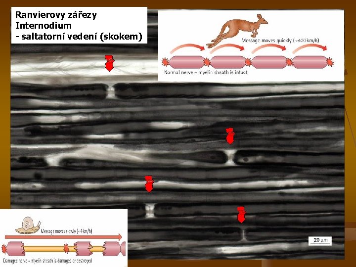 Ranvierovy zářezy Internodium - saltatorní vedení (skokem) 