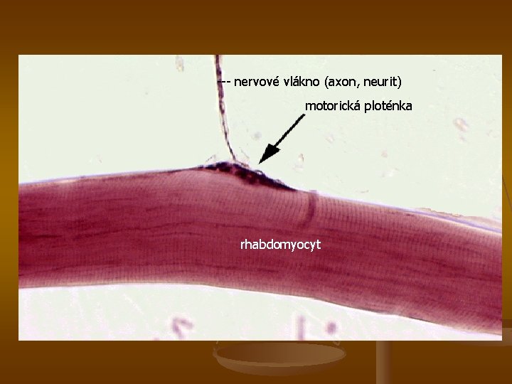 --- nervové vlákno (axon, neurit) motorická ploténka rhabdomyocyt 