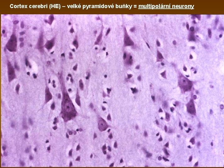 Cortex cerebri (HE) – velké pyramidové buňky = multipolární neurony 