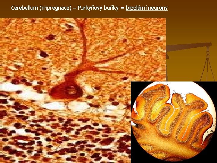 Cerebellum (impregnace) – Purkyňovy buňky = bipolární neurony 