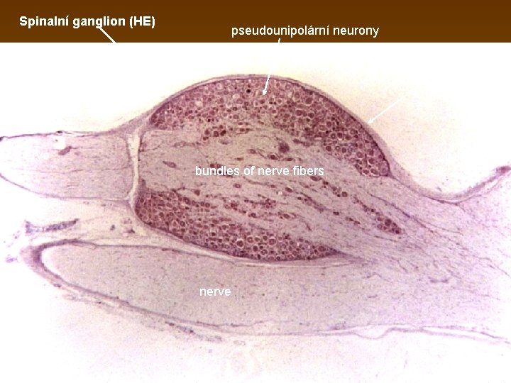 Spinalní ganglion (HE) pseudounipolární neurony epineurium nerve bundles of nerve fibers nerve 