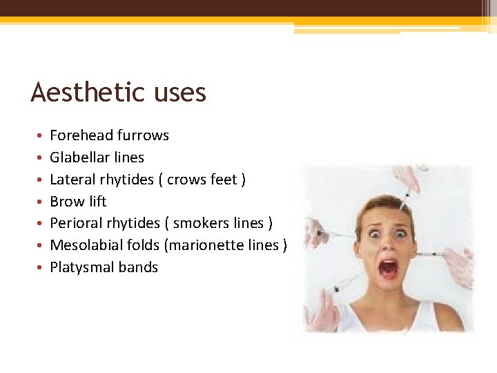 Aesthetic uses • • Forehead furrows Glabellar lines Lateral rhytides ( crows feet )